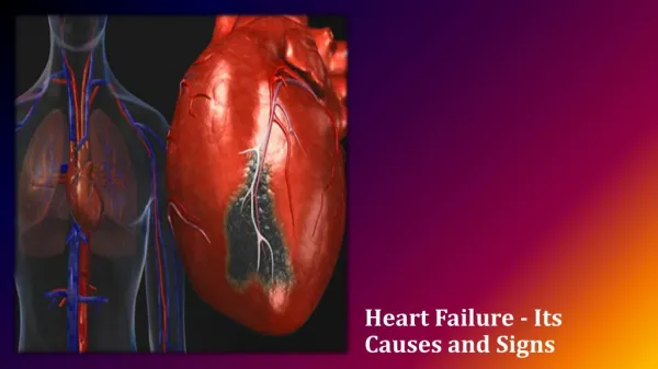 Heart Failure - Its Causes and Signs