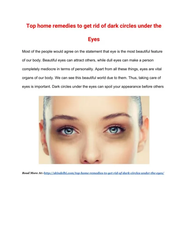 Top home remedies to get rid of dark circles under the eyes