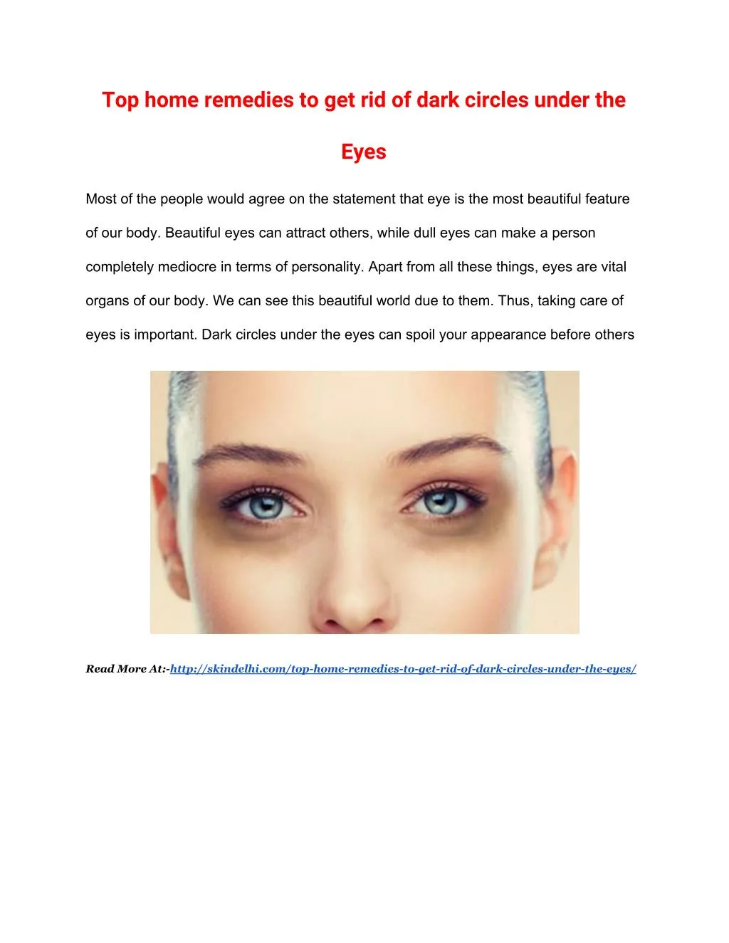top home remedies to get rid of dark circles
