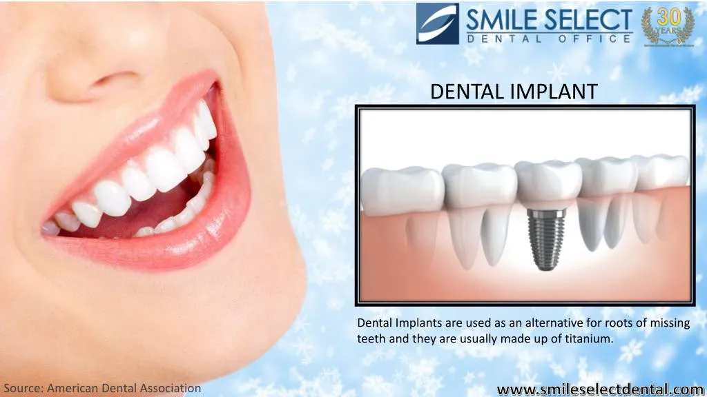 dental implant