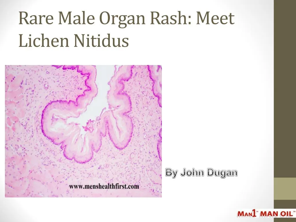 rare male organ rash meet lichen nitidus