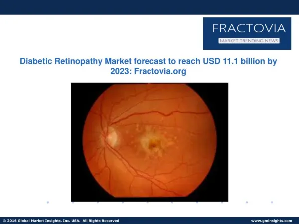 Diabetic Retinopathy Market share to reach USD 11.1 billion by 2023