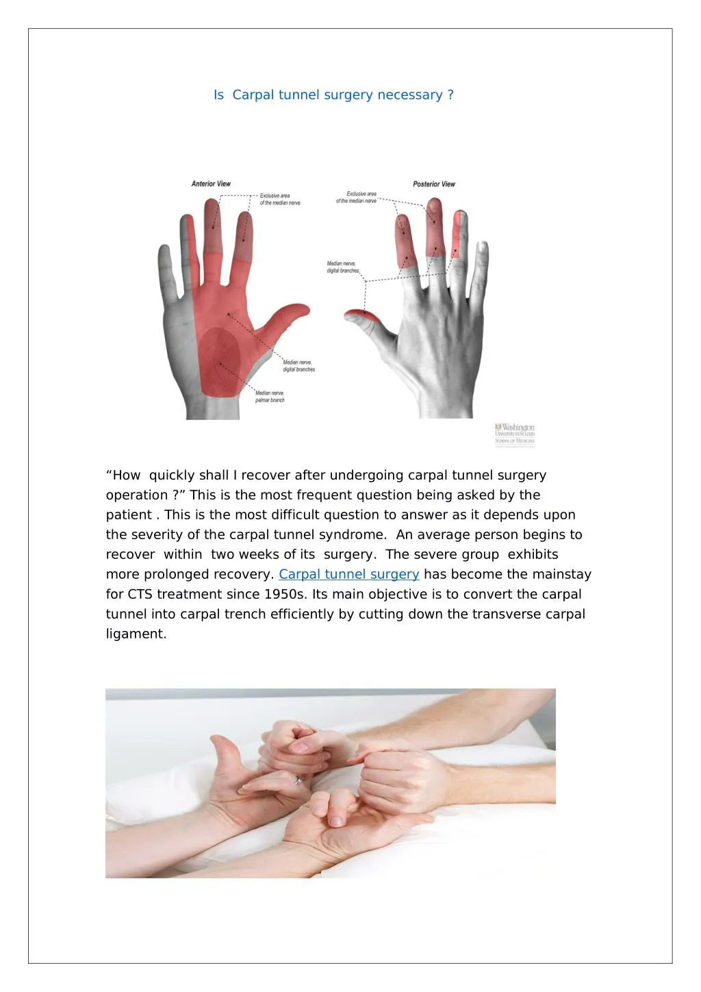 is carpal tunnel surgery necessary