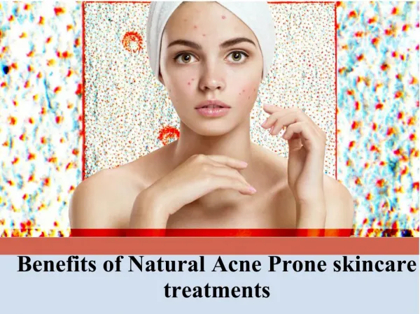 Benefits of Natural Acne Prone skincare treatments