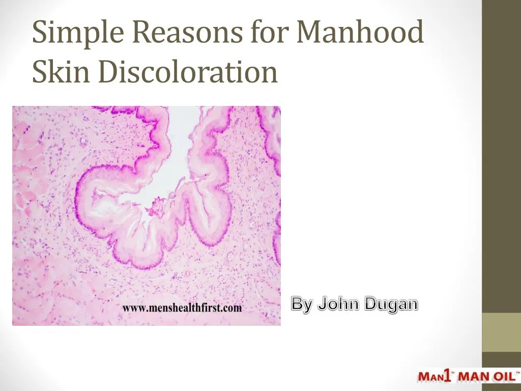 simple reasons for manhood skin discoloration