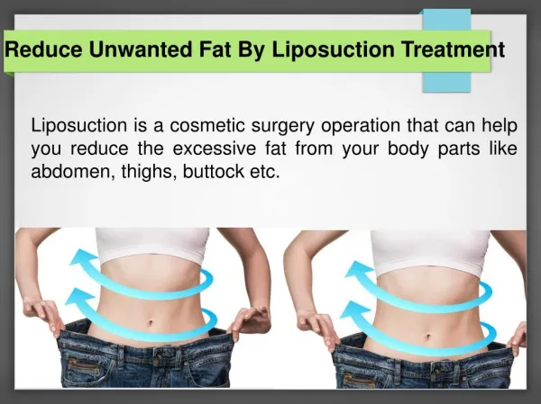 Reduce Your Body Fat with Liposuction Surgery