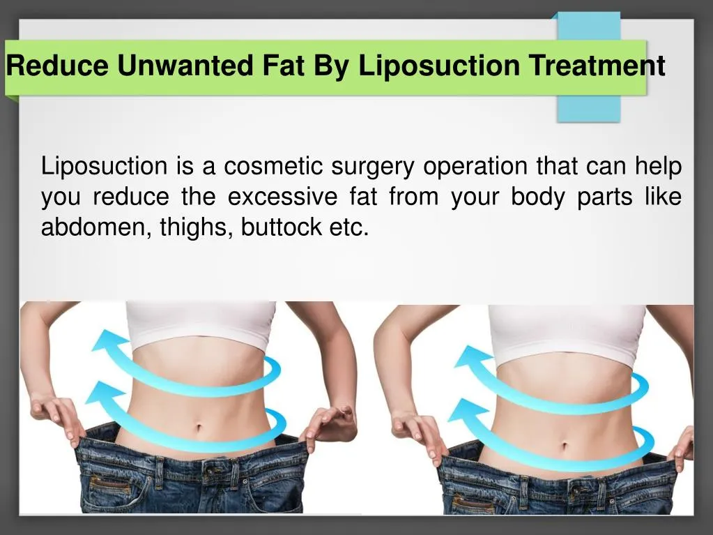 reduce unwanted fat by liposuction treatment