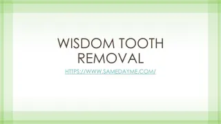 Wisdom teeth removal procedure - slide 1