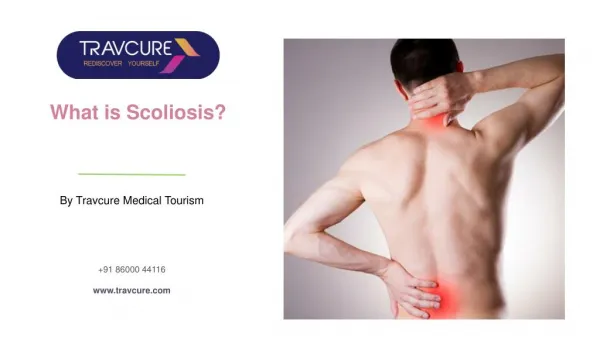 Scoliosis of the Spine: Causes, Types & Treatments