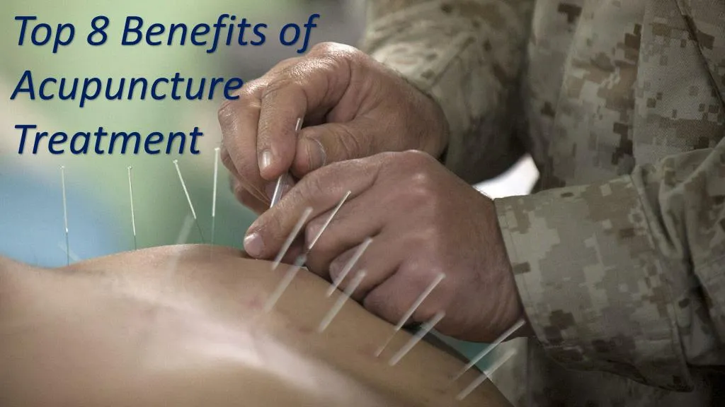 top 8 benefits of acupuncture treatment
