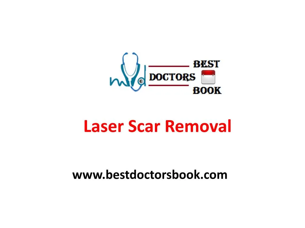 laser s car removal