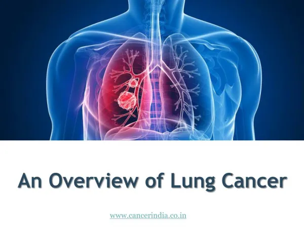 An Overview of Lung Cancer