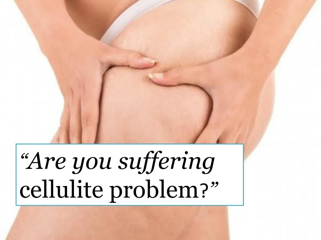 are you suffering cellulite problem