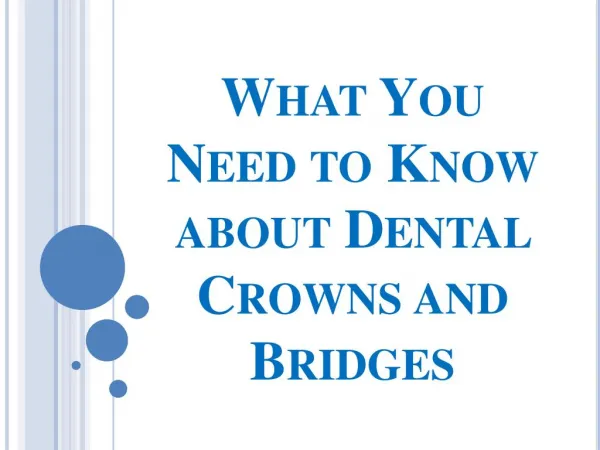 What You Need to Know about Dental Crowns and Bridges