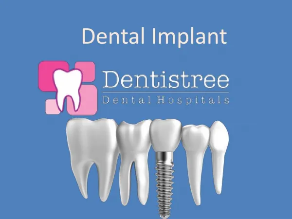 dental implanting