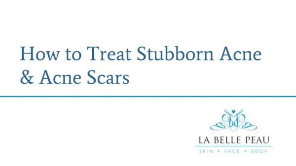 How to Treat Stubborn Acne & Acne Scars - La Belle Peau