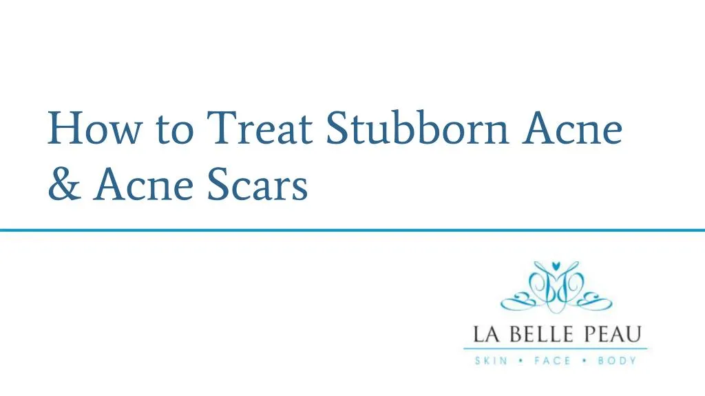 how to treat stubborn acne acne scars