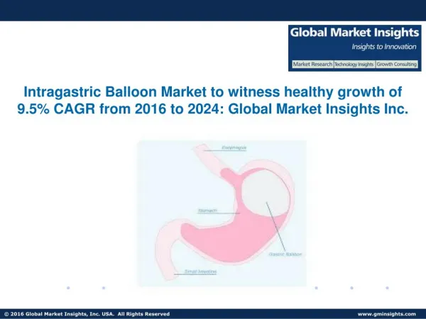 Global Intragastric Balloons Market to reach $270mn by 2024