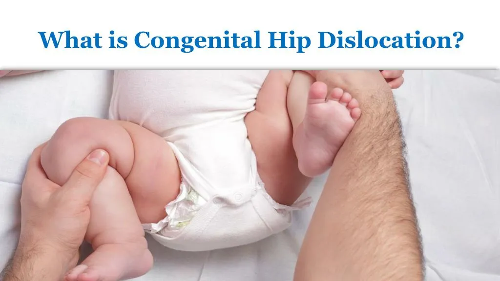 what is congenital hip dislocation