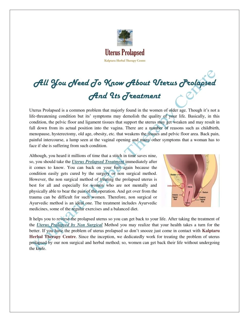 all you need to know about uterus prolapsed