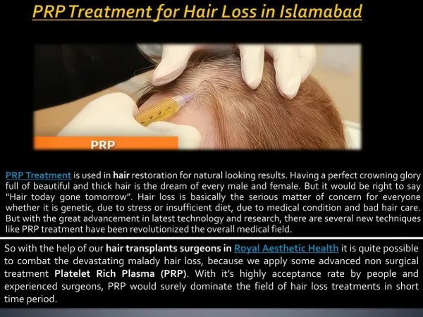 PRP Treatment in islamabad