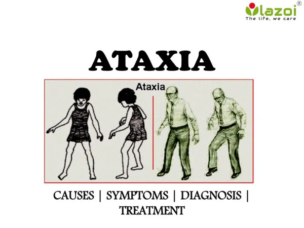 Ataxia : causes, symptoms, diagnosis and treatment