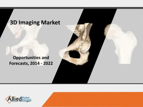 3D Imaging Market: Global Industry Report 2022