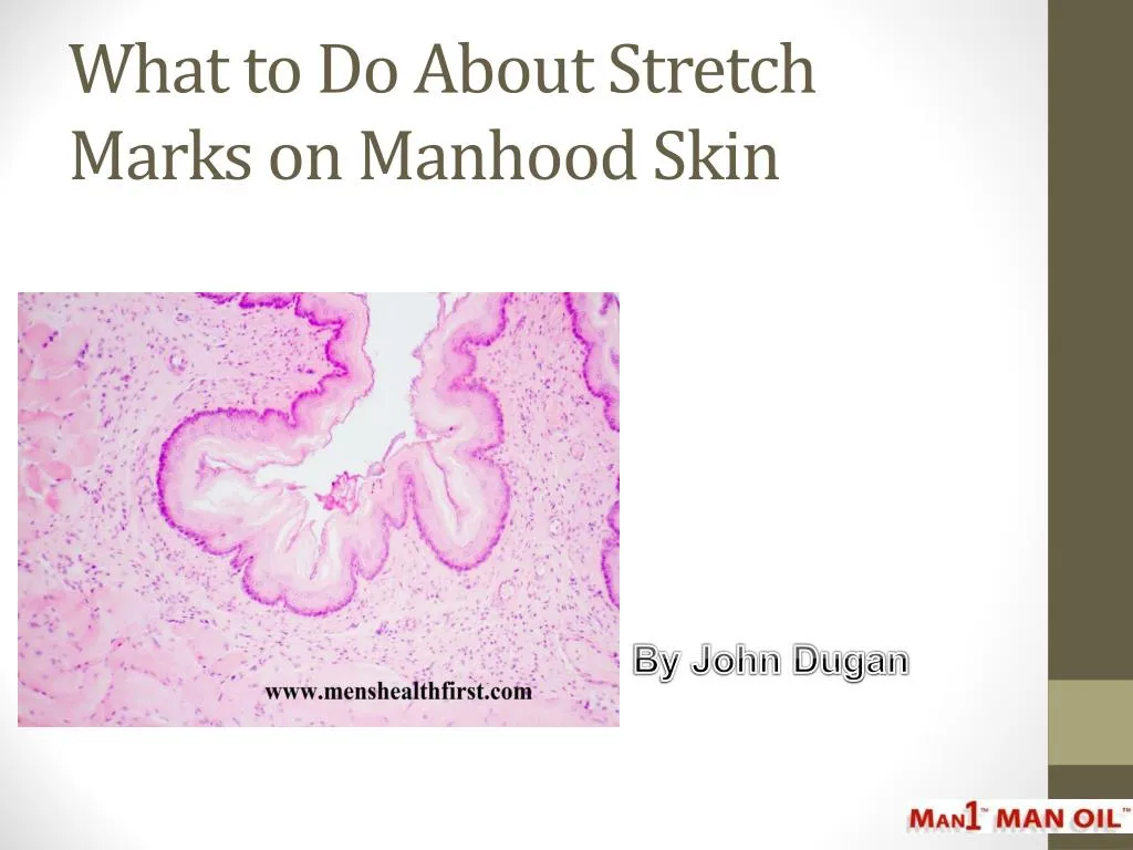 what to do about stretch marks on manhood skin