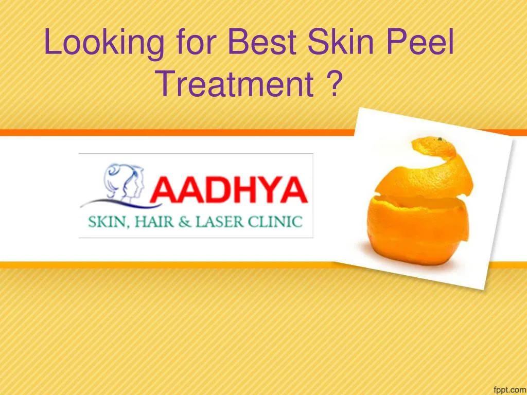 looking for best skin peel treatment