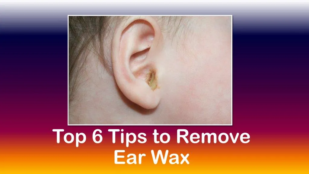 top 6 tips to remove ear wax