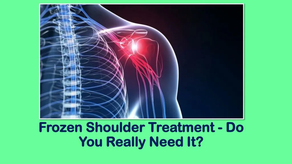 frozen shoulder treatment do you really need it