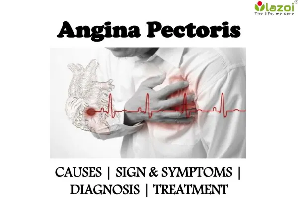 Angina pectoris : causes, symptoms, diagnosis and treatment