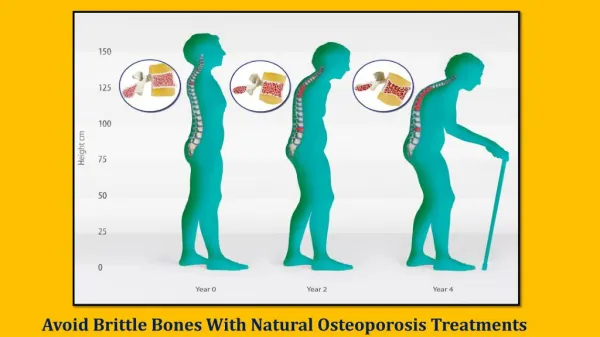 Osteoporosis Treatment Approaches Once you know you have osteoporosis, you have many options for treating the condition