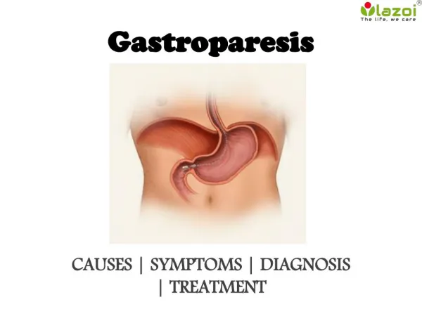 Gastroparesis : causes, symptoms, diagnosis and treatment