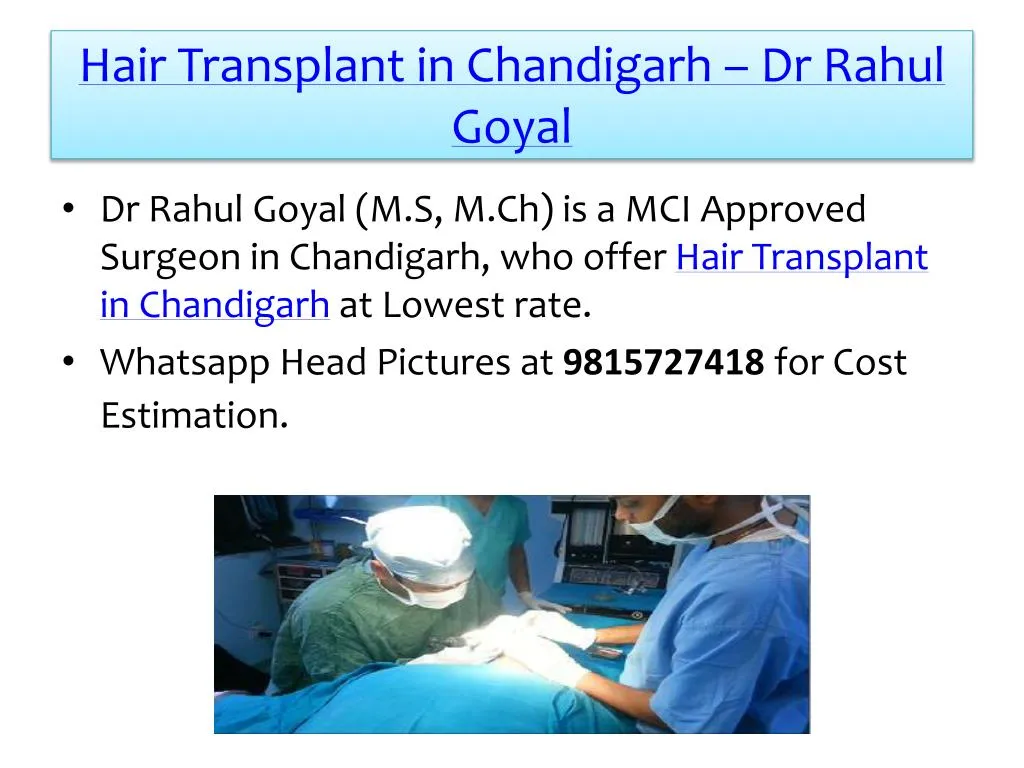 hair transplant in chandigarh dr rahul goyal