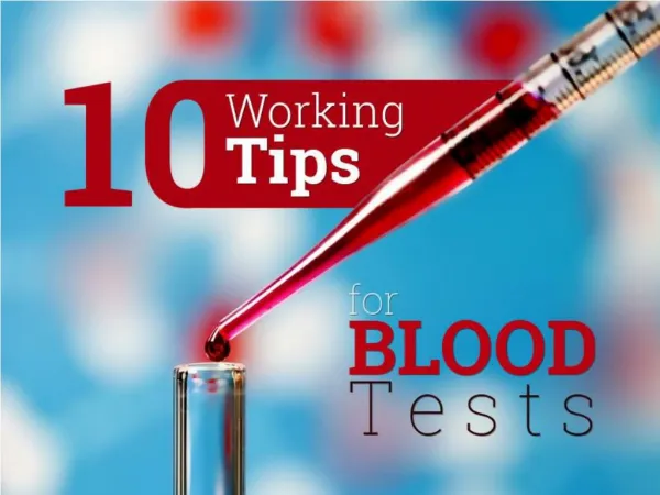 10 Working Tips for Blood Tests
