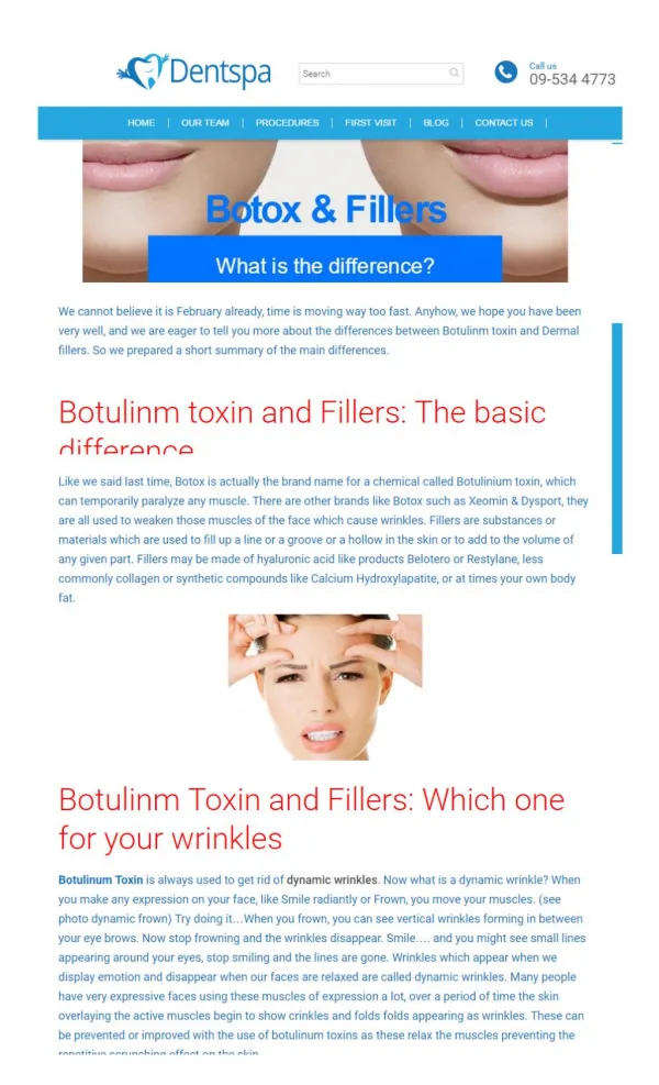 What Is The Difference Between Botox and Fillers? Know From Dentist Botany