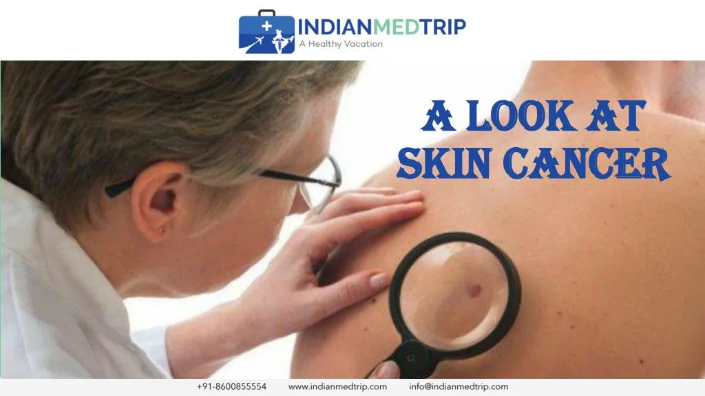 a look at skin cancer