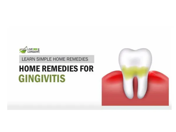 Best Home Remedies For Gingivitis