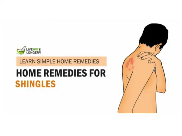Best Home Remedies For Shingles