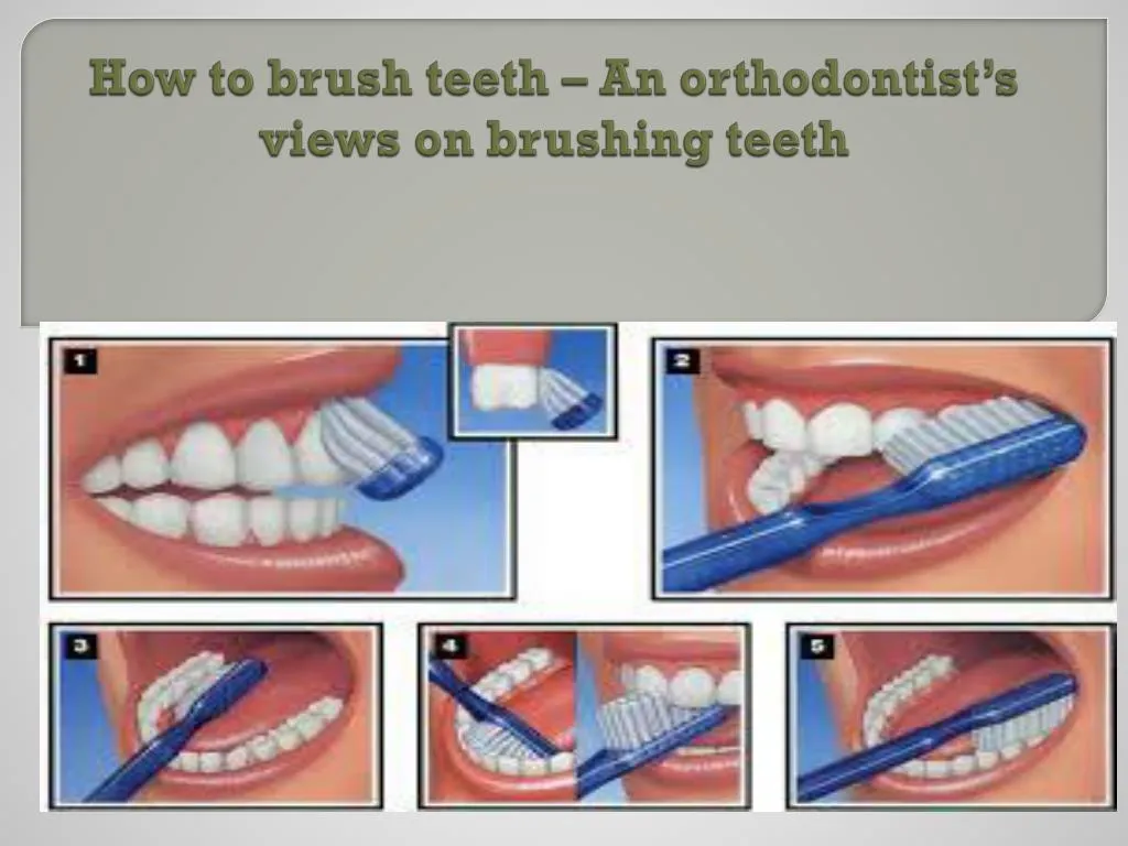 how to brush teeth an orthodontist s views on brushing teeth