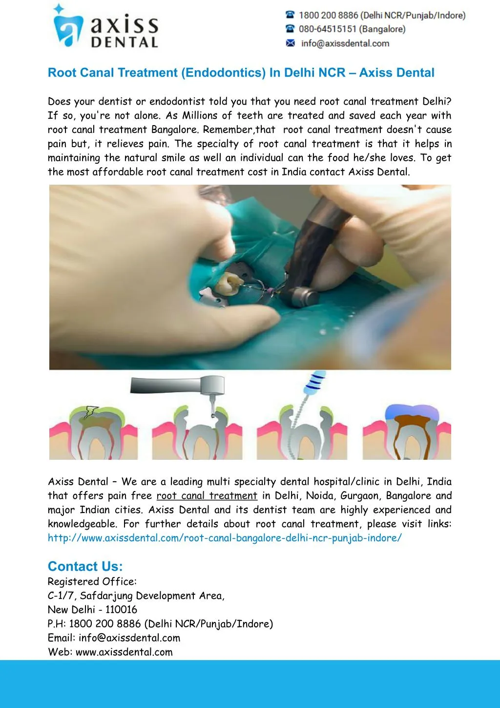 root canal treatment endodontics in delhi