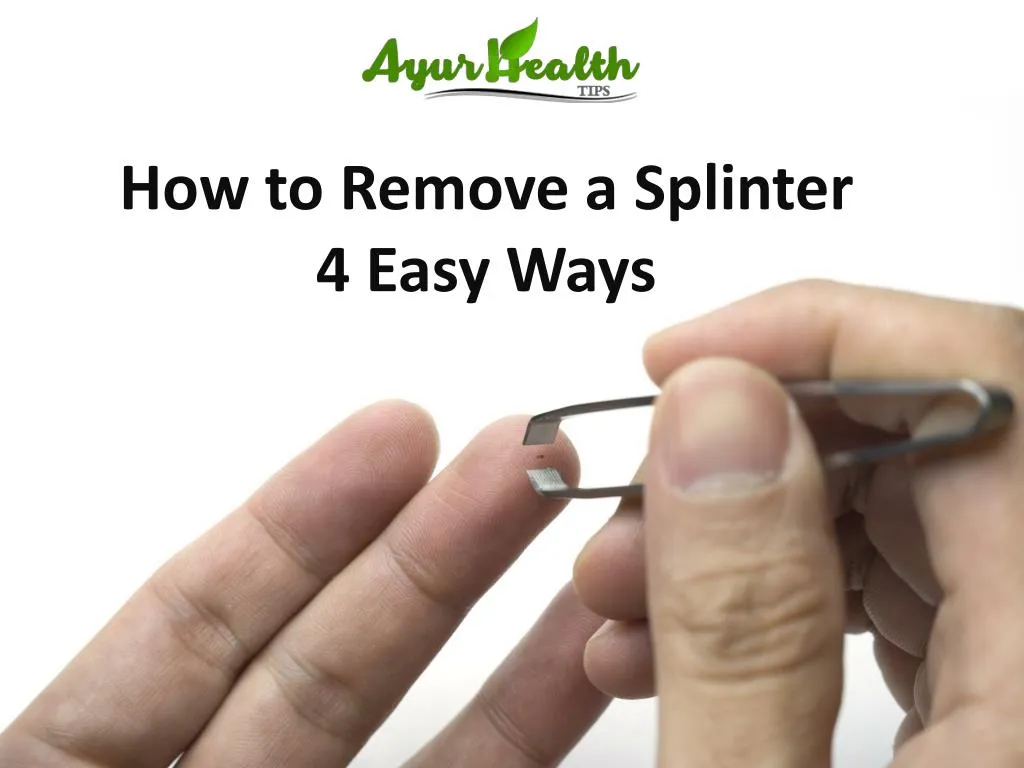 how to remove a splinter 4 easy ways