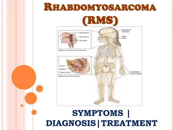 Rhabdomyosarcoma (RMS): Information on symptoms, diagnosis and treatment