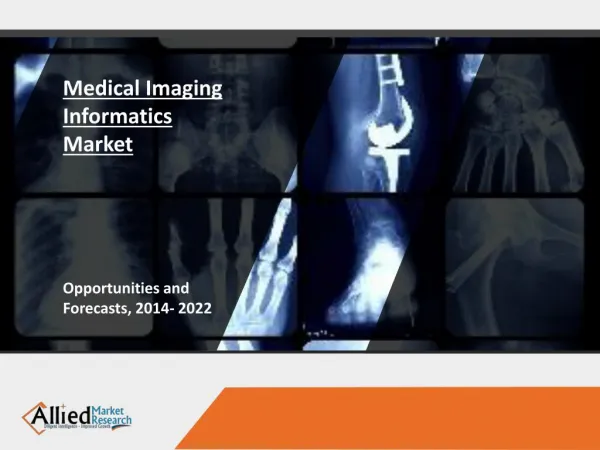Medical Imaging Informatics Market Forecast & Analysis from 2014-2022