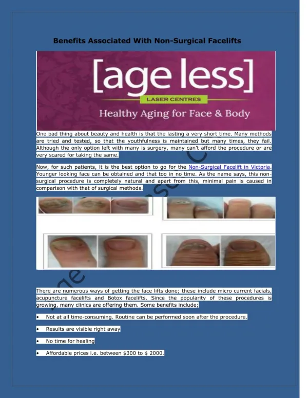 Age Less Laser Centres- Benefits Associated With Non-Surgical Facelifts