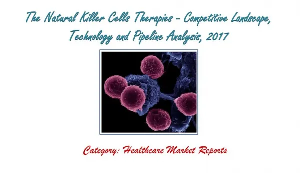 The Natural Killer Cells Therapies - Competitive Landscape, Technology and Pipeline Analysis, 2017: Aarkstore