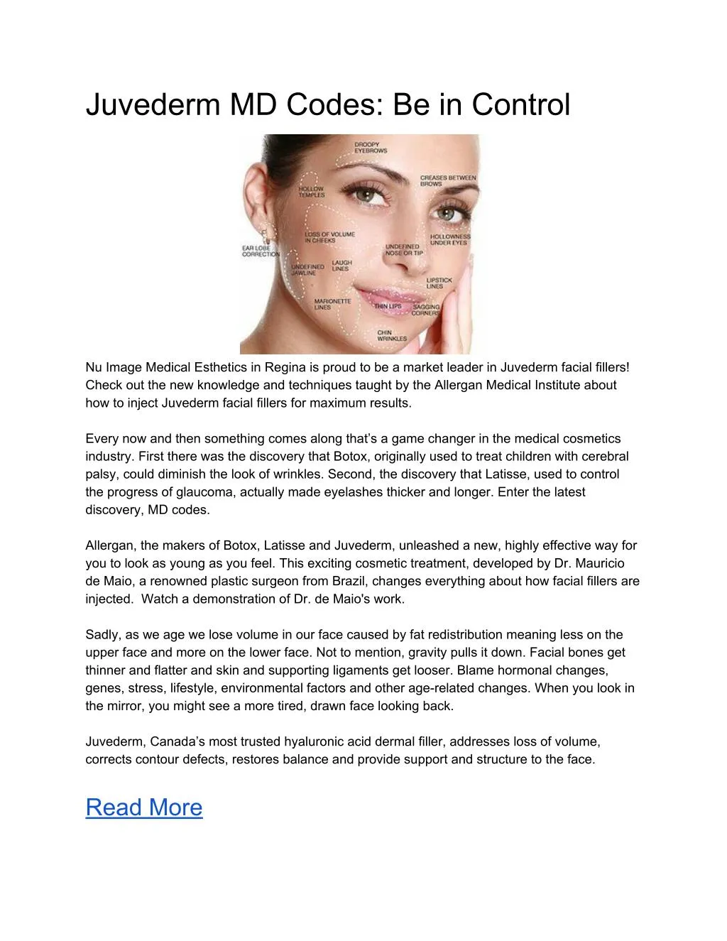 juvederm md codes be in control