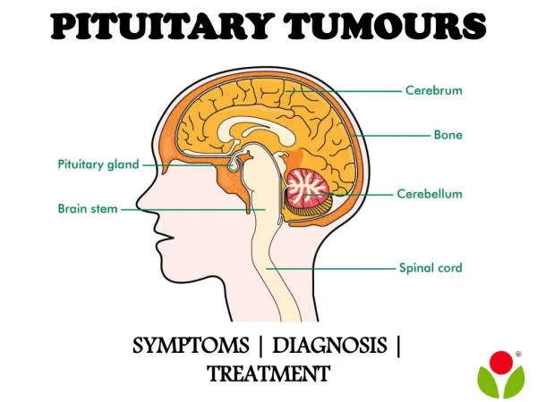 Pituitary tumours : symptoms, diagnosis and treatment