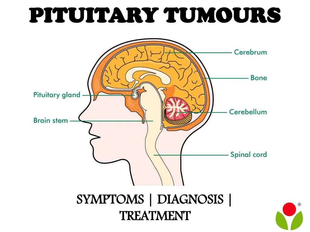pituitary tumours